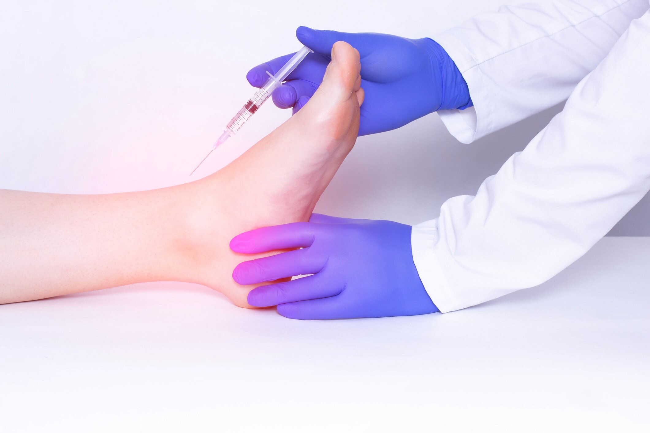 Corticosteroid Injections for Morton’s Neuroma vs. MTP Synovitis